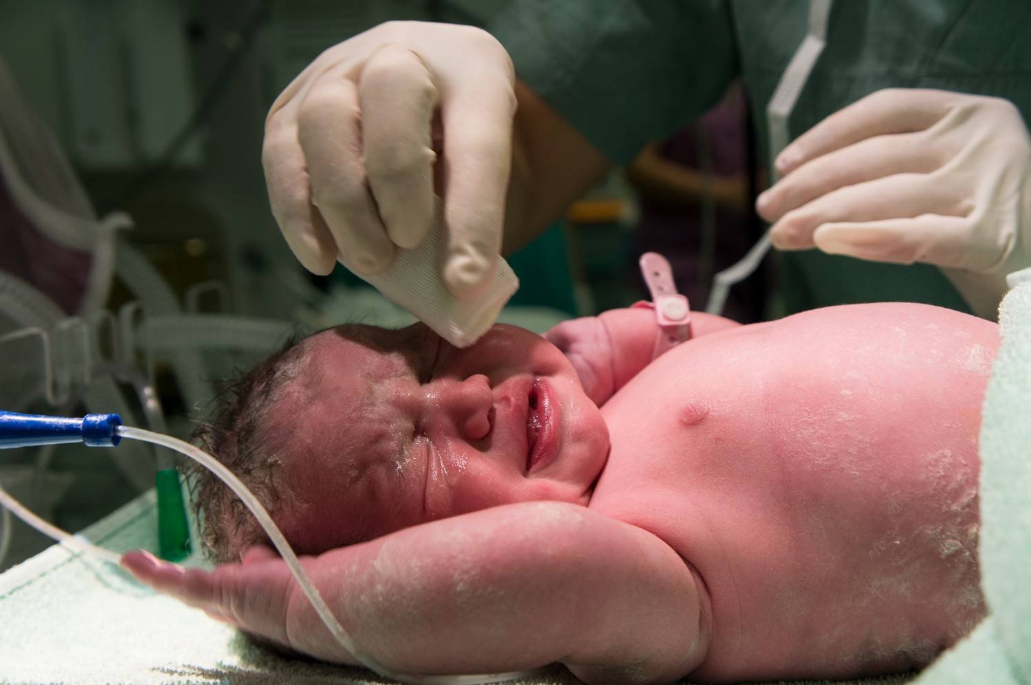 Best Neonatal OPD Services in New Delhi