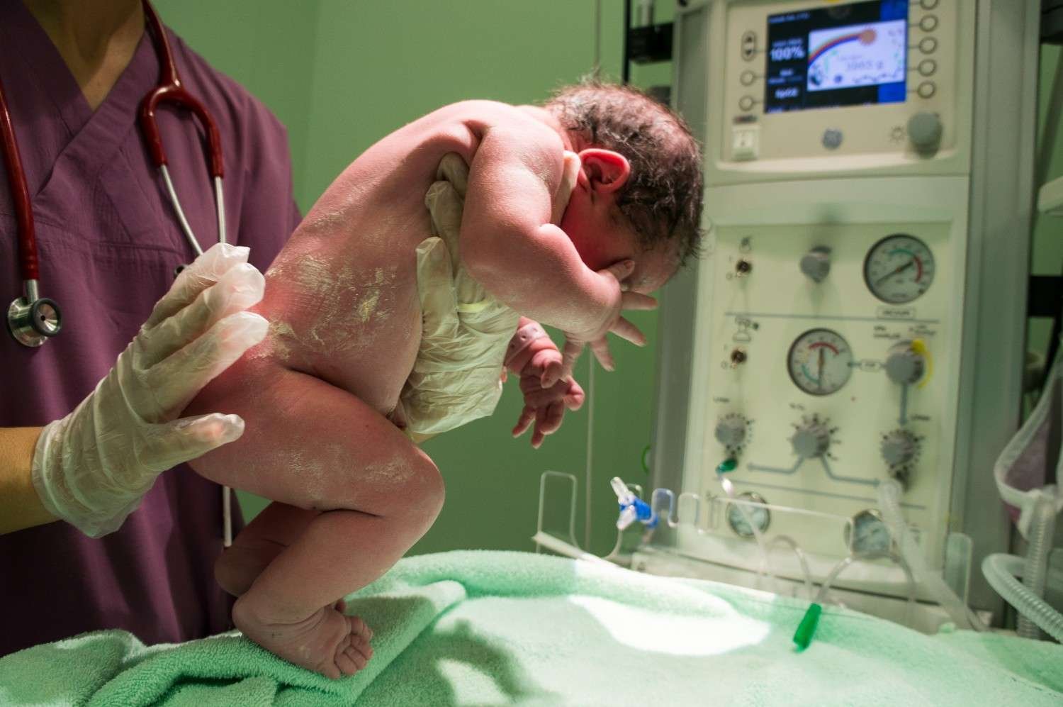 best Neonatal Echo treatment in West Vinod Nagar